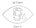 Cancer on Mesopotamian seal print, Wallenfels (1993)